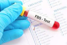 FBS සහ PPBS අතර වෙනස