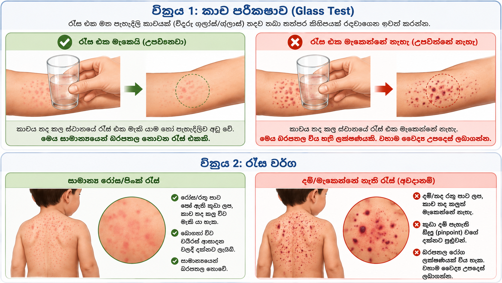 Glass test (වීදුරු පරීක්ෂාව): Rash that fades versus Rash that does not fade when pressed