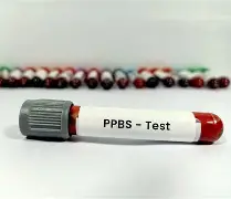 3 PPBS — ආහාර වේල් තුනෙන් පසු රුධිරයේ සීනි පරීක්ෂාව, දිනපතා සීනි ළිත